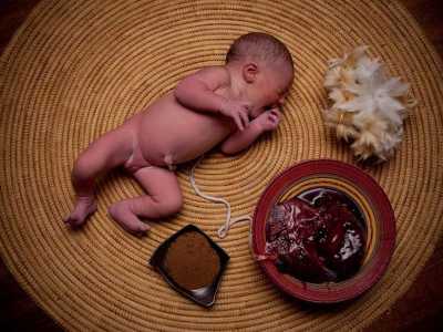 La pratica del Lotus birth: prevede che il bambino rimanga attaccato alla placenta tramite il cordone omblicale (che non viene quindi reciso)